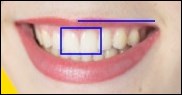 teeth